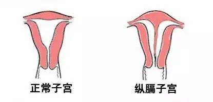 房間裝修設(shè)計(jì)圖_房間裝修效果圖_寶寶房間裝修